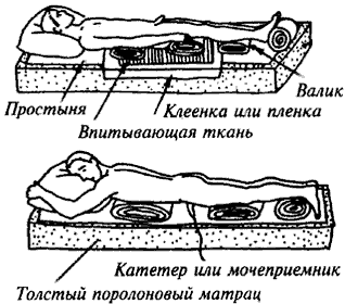 Положение больного на спине и животе для предотвращения пролежней.