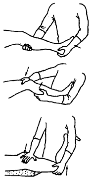 Упражнения для устранения контрактур суставов ноги.