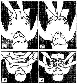 Помощь шейнику при откашливании.