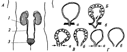 Типы мочевого пузыря у спинальников и фазы его работы.