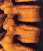 Позвоночник