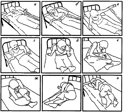 Как сесть или перевернуться с помощью петли на горизонтальном шнуре при поражении на уровне С7 (движения в запястье сохранены)